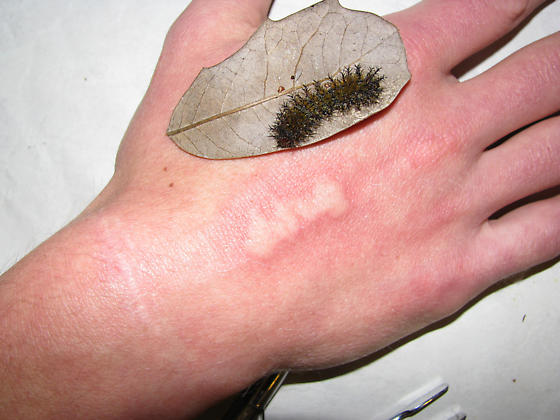 a green caterpillar placed near a hand rash